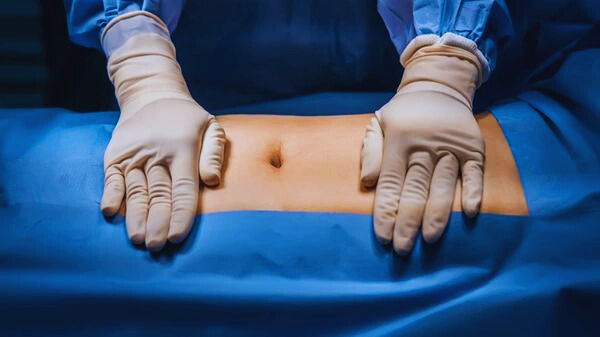 Types of Abdominal Surgery