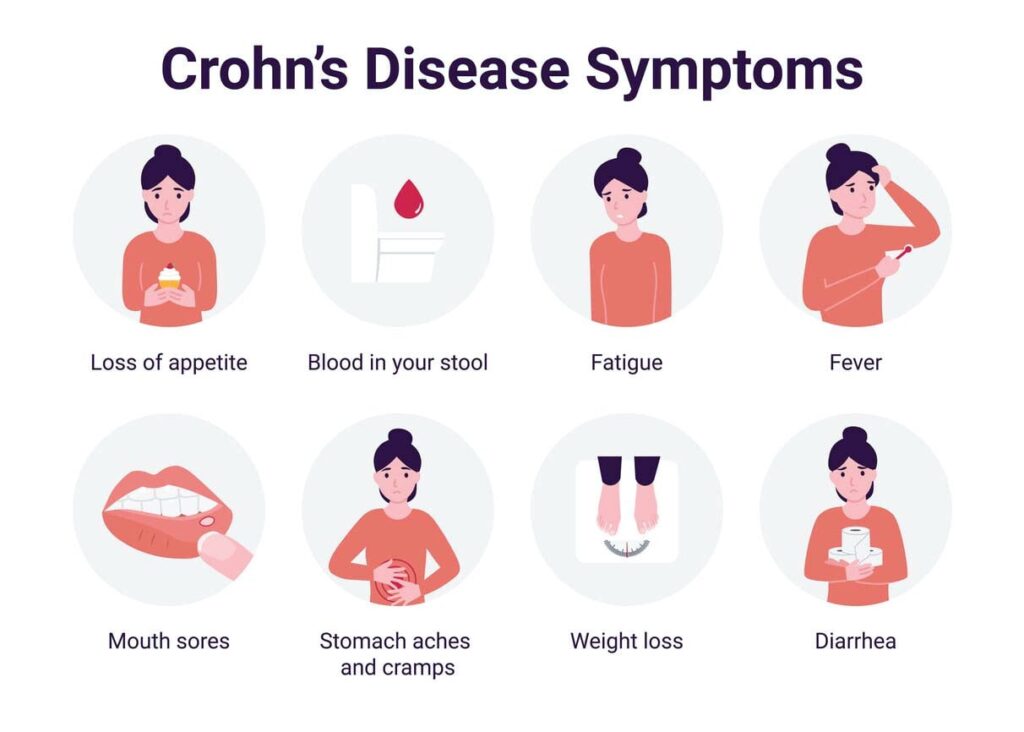 Crohn's Disease Symptoms