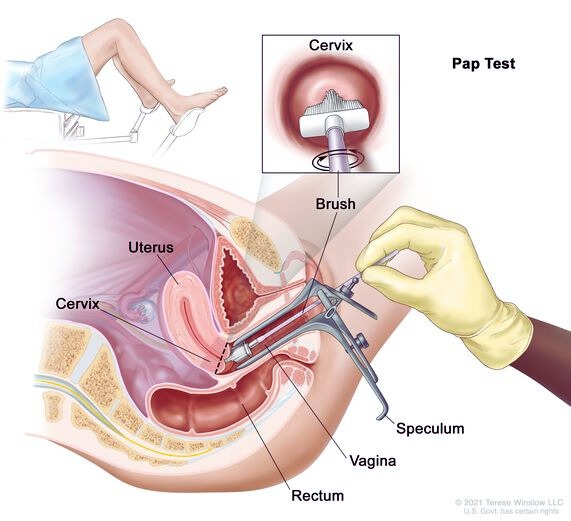 Why is a Pap Smear Important